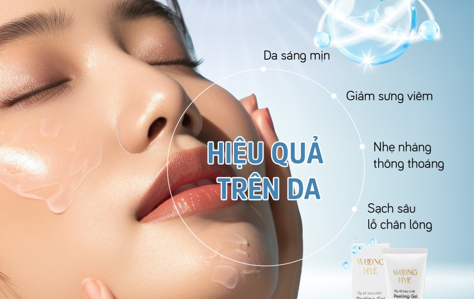 WOONG HYE - PEELING GEL HA - TẨY TẾ BÀO CHẾT